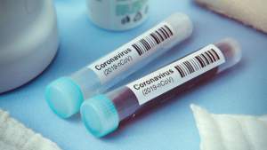 Alte nouă decese din cauza coronavirusului: bilanțul urcă la 478