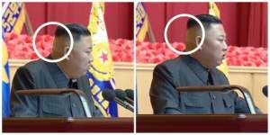 Bandajul de pe ceafa lui Kim Jong-un, un nou mister care stârnește semne de întrebare cu privire la starea sa de sănătate