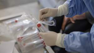 Coronavirus în România: 808 cazuri noi, din doar 7.940 de teste