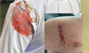 Polițist rănit cu o sapă: agresorul, iertat de procuror. Sindicatul Europol: „Inclusiv procurorul subminează autoritatea poliției”