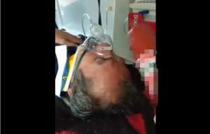 Revoltător! Pacient lovit peste cap cu un baton de parizer de echipajul unei ambulanțe SMURD (VIDEO)