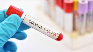 Coronavirus în România: 10.108 cazuri noi și 167 de decese, în ultimele 24 de ore