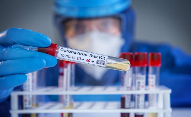 Coronavirus în România: 1.059 de noi cazuri și 45 de decese. Crește numărul pacienților de la ATI