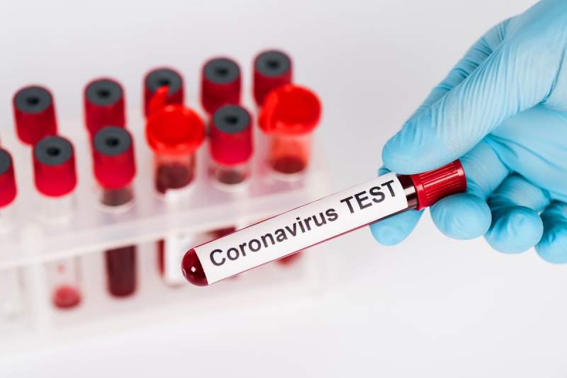 Încă nouă decese din cauza coronavirusului: bilanțul urcă la 628