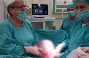Tumoră gigant de 24 de kilograme scoasă din abdomenul unei femei din Botoșani