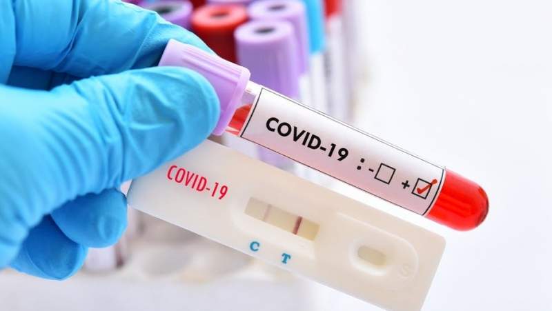 Coronavirus în România: Alte 2.830 de infecții și 63 de decese asociate Covid