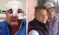 Sălbăticie la Lungani: om bătut măr, Poliția pe-o mână cu agresorii