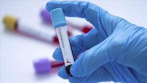 Încă 10 persoane infectate cu noul coronavirus au murit: bilanțul deceselor urcă la 790