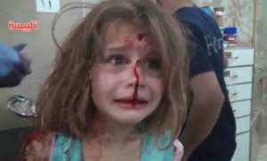 Imagini dramatice din Siria: o fetiță rănită într-un bombardament își strigă cu disperare tatăl (VIDEO