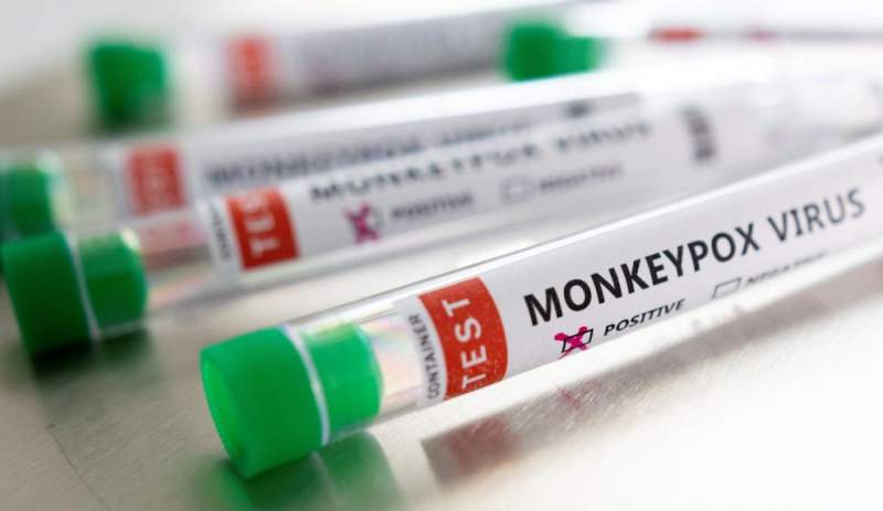 Un nou caz de variola maimuței în România: bilanțul a urcat la 15 îmbolnăviri