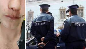 Polițiștii din Botoșani, acuzații extrem de grave: o femeie reclamă că oamenii legii i-au nenorocit în bătaie băiatul