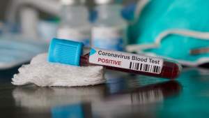 Un bărbat de 52 de ani, al 14-lea deces în România provocat de coronavirus